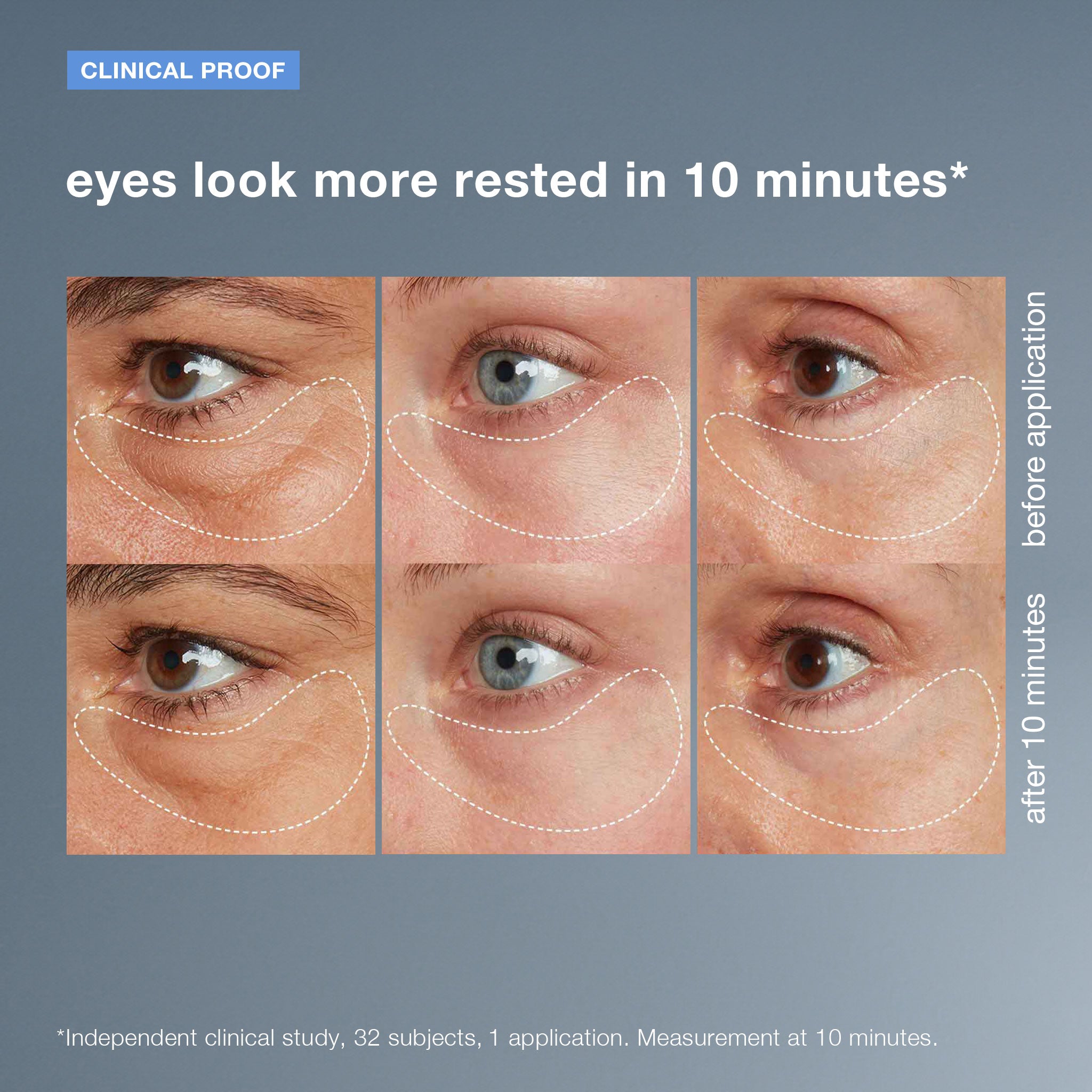 awaken peptide depuffing eye gel